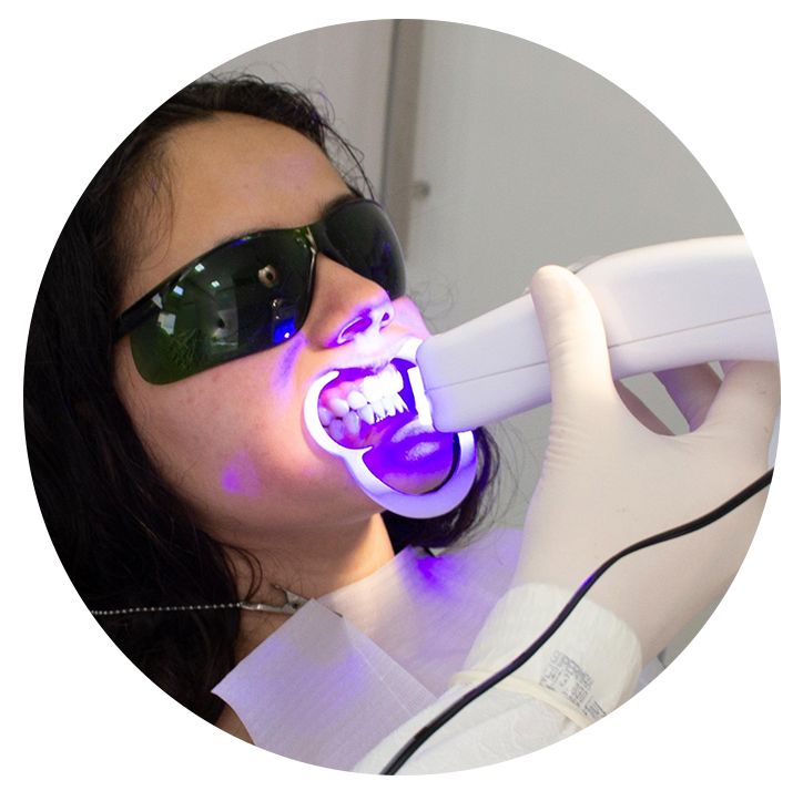 Clareamento dentário 1