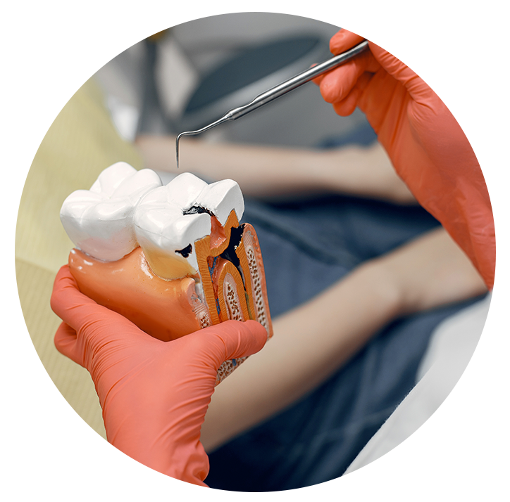 Tratamento de canal(endodontia)